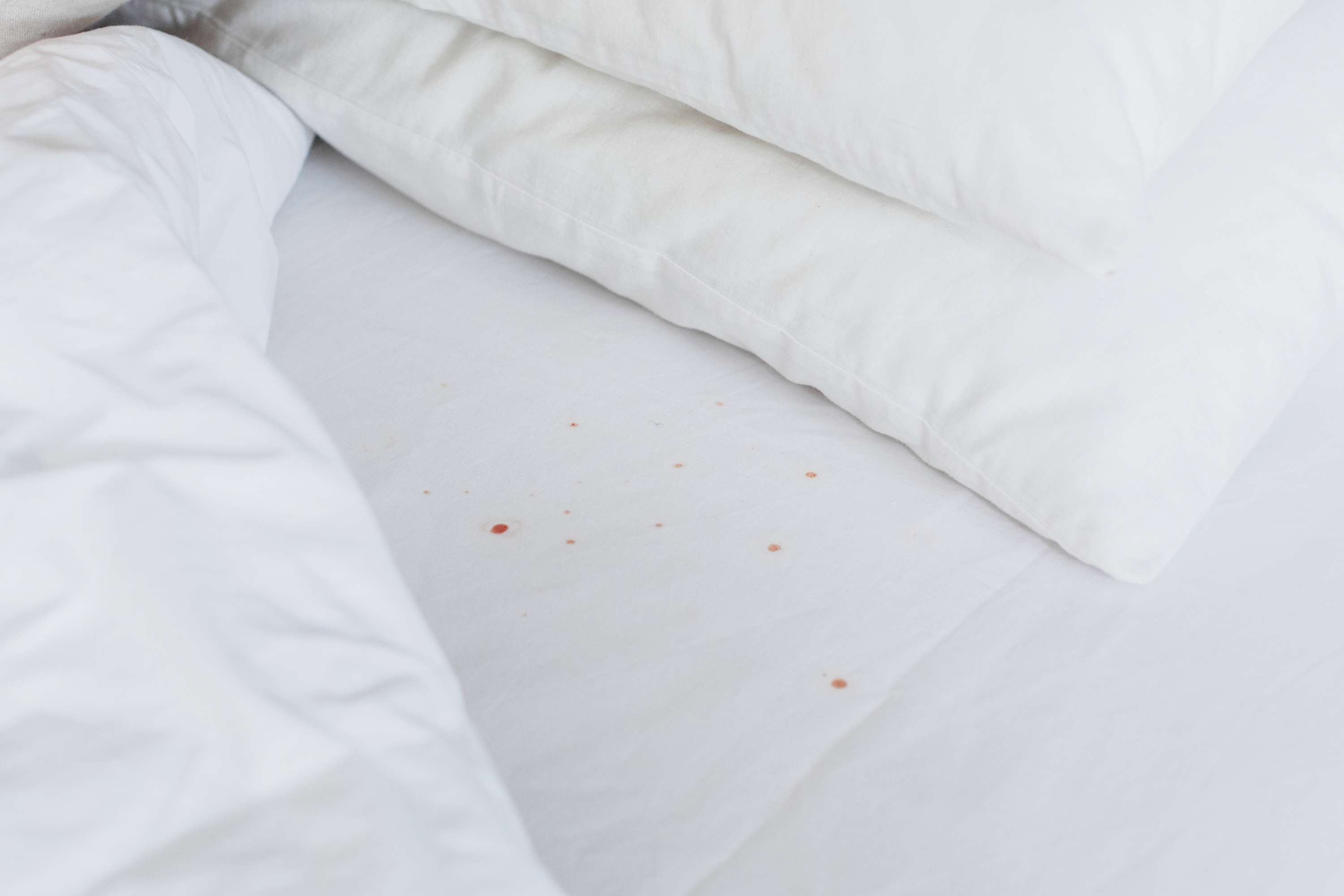 How To Identify Bed Bug Stains?