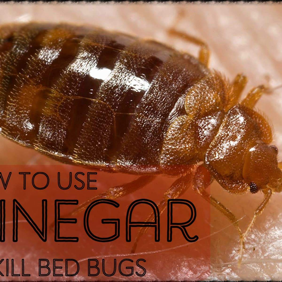 How To Prevent Bed Bugs From Entering Hair