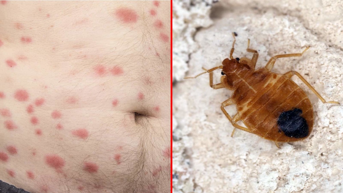 Signs Of Bed Bug Infestation